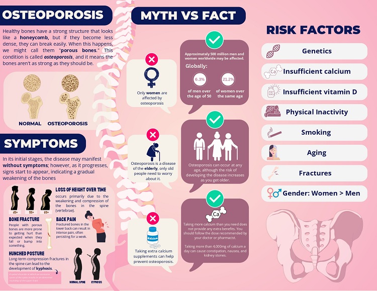 03262024.Web L2 Brochure Osteoporosis 2